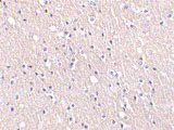 Immunohistochemistry (Formalin/PFA-fixed paraffin-embedded sections) - Anti-CIDE A antibody (AB62343)