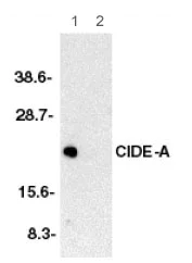 Western blot - Anti-CIDE A antibody (AB62343)