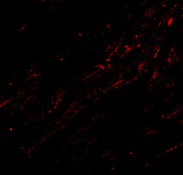 Immunocytochemistry/ Immunofluorescence - Anti-CIDE A antibody (AB8402)