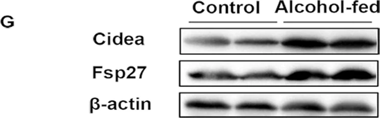 Western blot - Anti-CIDE A antibody (AB8402)