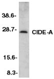Western blot - Anti-CIDE A antibody (AB8402)