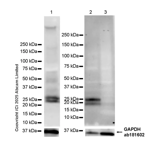 Western blot - Anti-CIDE A antibody [EPR30276-574] (AB324684)