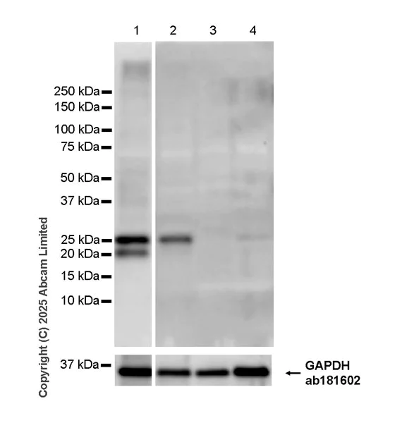 Western blot - Anti-CIDE A antibody [EPR30276-574] - BSA and Azide free (AB324691)
