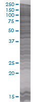 CIDE A overexpression 293T lysate (whole cell)