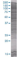 SDS-PAGE - CIDE A overexpression 293T lysate (whole cell) (AB94105)