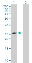Western blot - CIDE A overexpression 293T lysate (whole cell) (AB94105)