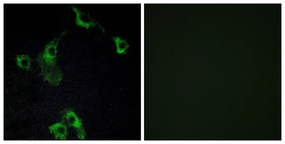 Immunocytochemistry/ Immunofluorescence - Anti-CIDE B antibody (AB196595)