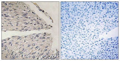 Immunohistochemistry (Formalin/PFA-fixed paraffin-embedded sections) - Anti-CIDE B antibody (AB196595)