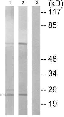 Western blot - Anti-CIDE B antibody (AB196595)