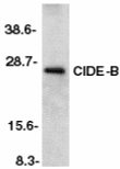 Western blot - Anti-CIDE B antibody (AB8403)