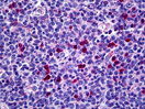 Immunohistochemistry (Formalin/PFA-fixed paraffin-embedded sections) - Anti-CIITA antibody (AB117598)