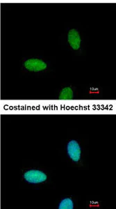 Immunocytochemistry/ Immunofluorescence - Anti-CIKS/ACT1 antibody (AB137395)