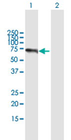 Western blot - Anti-CIKS/ACT1 antibody (AB172509), expandable thumbnail