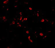 Immunocytochemistry/ Immunofluorescence - Anti-CIKS/ACT1 antibody (AB5973)