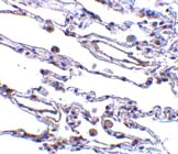 Immunohistochemistry (Formalin/PFA-fixed paraffin-embedded sections) - Anti-CIKS/ACT1 antibody (AB5973)