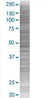 SDS-PAGE - CIKS overexpression 293T lysate (whole cell) (AB94245)