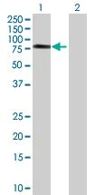 Western blot - CIKS overexpression 293T lysate (whole cell) (AB94245)