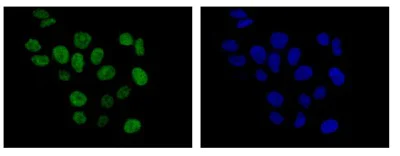 Immunocytochemistry/ Immunofluorescence - Anti-CINP antibody [EPR14445] - BSA and Azide free (AB250671)