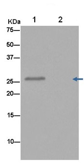 Immunoprecipitation - Anti-CINP antibody [EPR14445] - BSA and Azide free (AB250671), expandable thumbnail