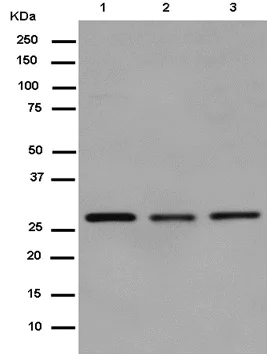 Western blot - Anti-CINP antibody [EPR14445] - BSA and Azide free (AB250671)