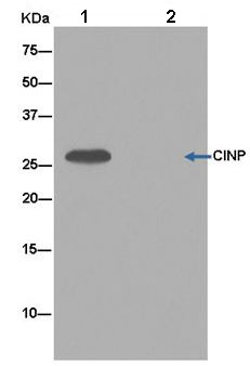 Immunoprecipitation - Anti-CINP antibody [EPR14446] (AB180955)