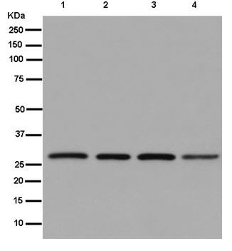 Western blot - Anti-CINP antibody [EPR14446] (AB180955)