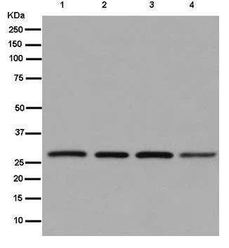 Western blot - Anti-CINP antibody [EPR14446] - BSA and Azide free (AB250285)