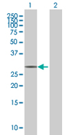 Western blot - Anti-CIP29 antibody (AB67569)