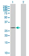 Western blot - Anti-CIP29 antibody (AB67569)