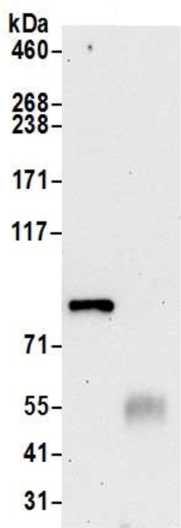 Immunoprecipitation - Anti-CIP2A antibody [2A1-9A4] (AB128179)