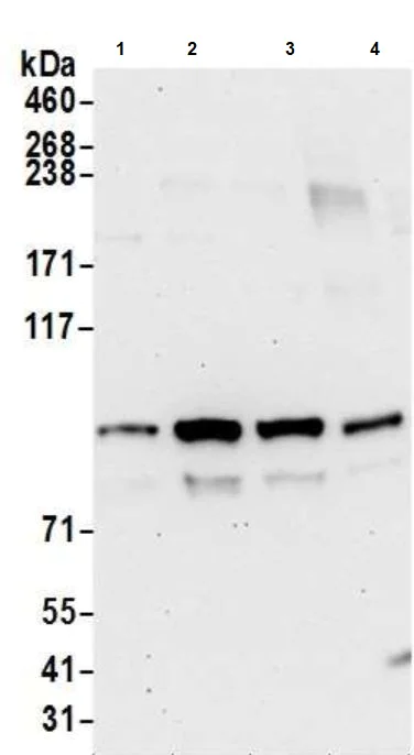 Western blot - Anti-CIP2A antibody [2A1-9A4] (AB128179)