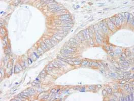 Immunohistochemistry (Formalin/PFA-fixed paraffin-embedded sections) - Anti-CIP2A antibody (AB84547)