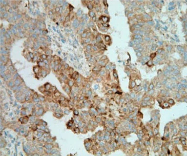 Immunohistochemistry (Formalin/PFA-fixed paraffin-embedded sections) - Anti-CIP2A antibody (AB84547)