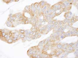 Immunohistochemistry (Formalin/PFA-fixed paraffin-embedded sections) - Anti-CIP2A antibody (AB84547)