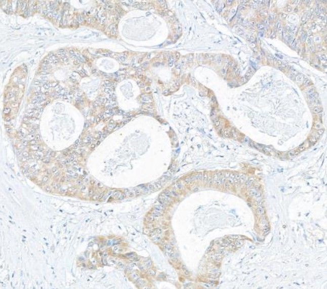 Immunohistochemistry (Formalin/PFA-fixed paraffin-embedded sections) - Anti-CIP2A antibody (AB99518)