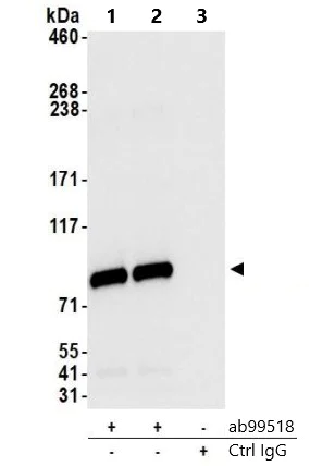 Immunoprecipitation - Anti-CIP2A antibody (AB99518)