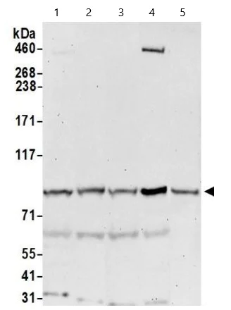 Western blot - Anti-CIP2A antibody (AB99518)