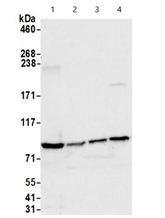 Western blot - Anti-CIP2A antibody (AB99518)