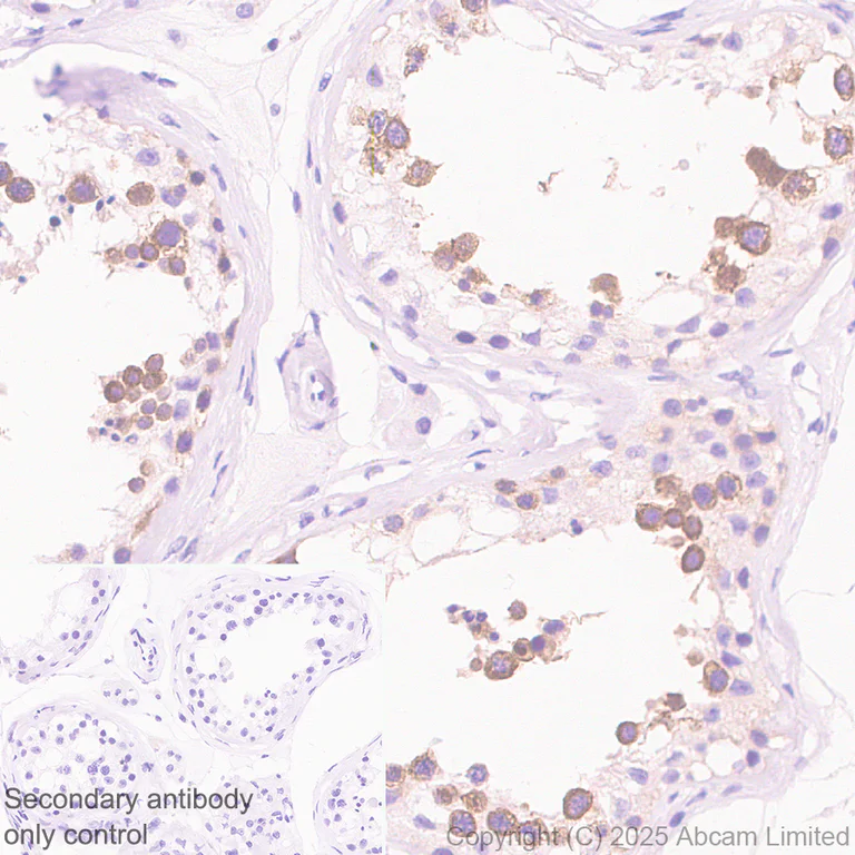 Immunohistochemistry (Formalin/PFA-fixed paraffin-embedded sections) - Anti-CIP2A antibody [EPR29632-7] (AB325239)