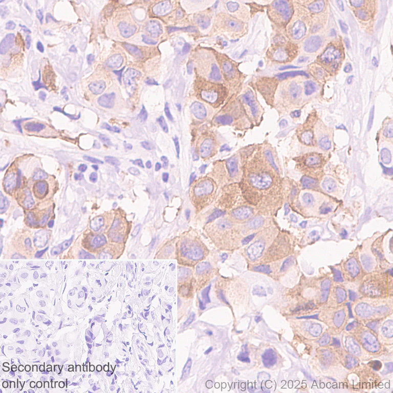 Immunohistochemistry (Formalin/PFA-fixed paraffin-embedded sections) - Anti-CIP2A antibody [EPR29632-7] (AB325239)