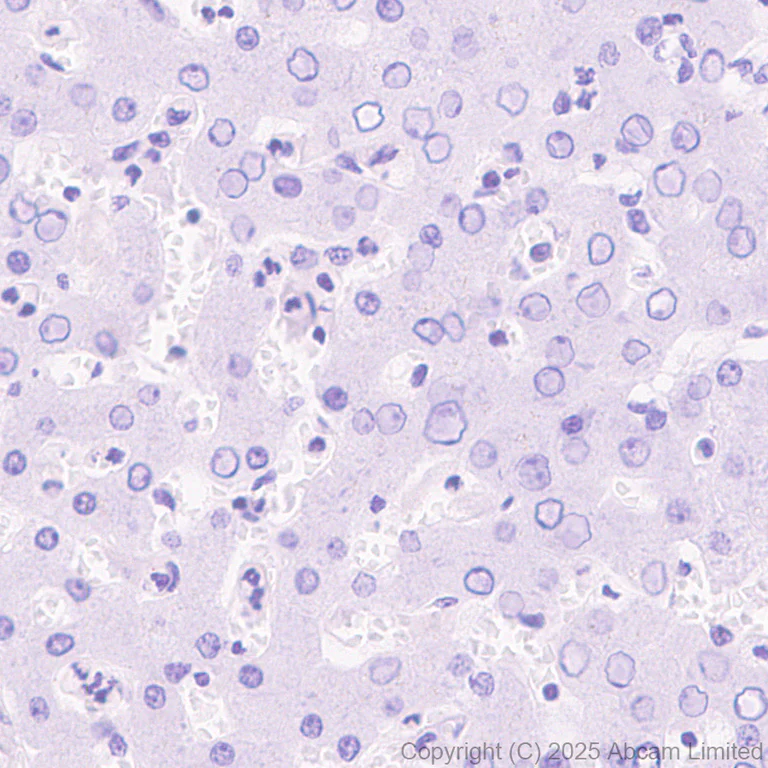 Immunohistochemistry (Formalin/PFA-fixed paraffin-embedded sections) - Anti-CIP2A antibody [EPR29632-7] (AB325239)
