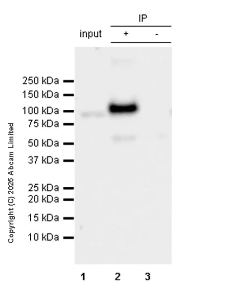 Immunoprecipitation - Anti-CIP2A antibody [EPR29632-7] (AB325239)