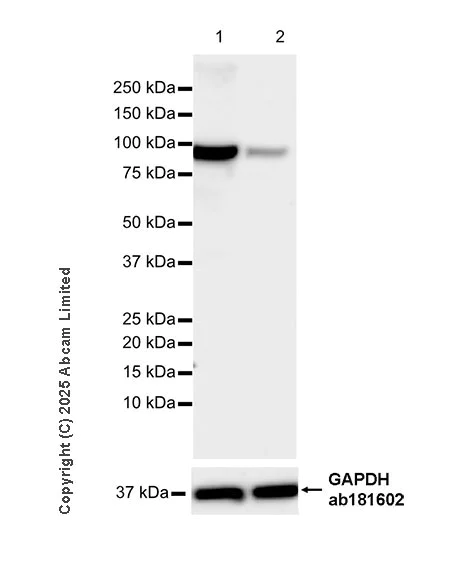 Western blot - Anti-CIP2A antibody [EPR29632-7] (AB325239)