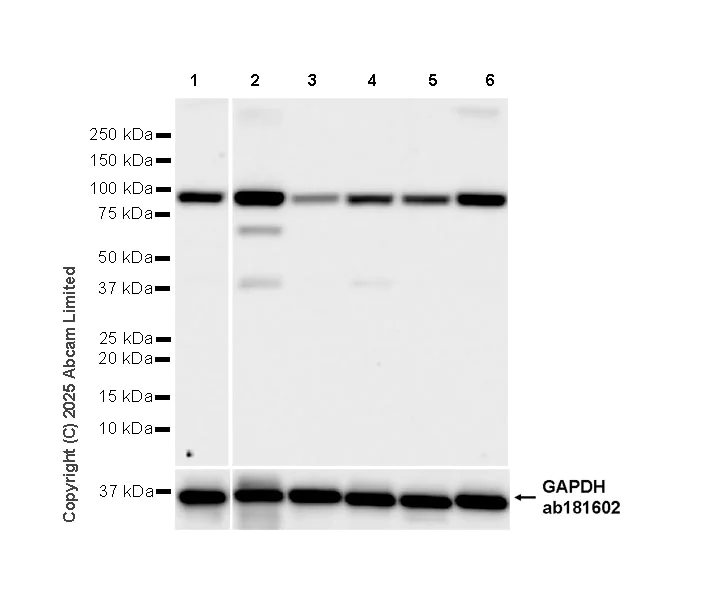 Western blot - Anti-CIP2A antibody [EPR29632-7] (AB325239)