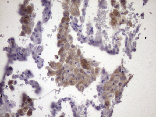Immunohistochemistry (Formalin/PFA-fixed paraffin-embedded sections) - Anti-CIP2A antibody [OTI9E6] (AB236506)
