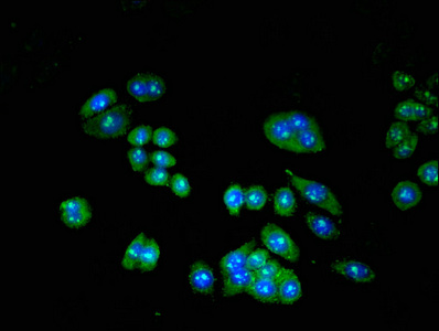 Immunocytochemistry/ Immunofluorescence - Anti-Cip4 antibody (AB235913)