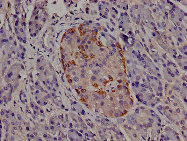 Immunohistochemistry (Formalin/PFA-fixed paraffin-embedded sections) - Anti-Cip4 antibody (AB235913)