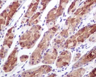 Immunohistochemistry (Formalin/PFA-fixed paraffin-embedded sections) - Anti-Cip4 antibody [EPR1965] (AB108313)