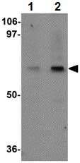 Western blot - Anti-CIP75 antibody (AB106443)