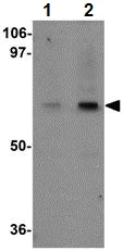 Western blot - Anti-CIP75 antibody (AB106443)